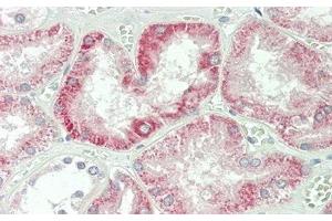 Detection of IFNb in Human Kidney Tissue using Polyclonal Antibody to Interferon Beta (IFNb) (IFNB1 抗体  (AA 22-187))
