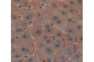Immunohistochemistry (IHC) image for anti-Nuclear Receptor Subfamily 3, Group C, Member 1 (Glucocorticoid Receptor) (NR3C1) (AA 622-755) antibody (ABIN1173541)