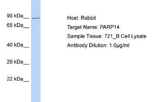 Host: Rabbit Target Name: PARP14 Sample Type: 721_B Whole Cell lysates Antibody Dilution: 1. (PARP14 抗体  (C-Term))