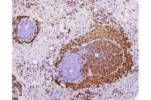 IHC analysis of PAX5 using anti-PAX5 antibody (ABIN7600655).