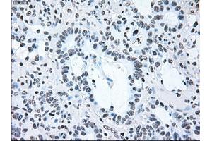 Image no. 2 for anti-B-Raf proto-oncogene, serine/threonine kinase (BRAF) antibody (ABIN1496961) (BRAF 抗体)