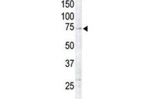 Western Blotting (WB) image for anti-Ribosomal Protein S6 Kinase, 90kDa, Polypeptide 6 (RPS6KA6) antibody (ABIN5023859) (RPS6KA6 抗体)