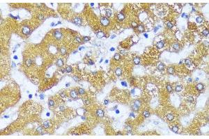 Immunohistochemistry of paraffin-embedded Human liver using ACOX2 Polyclonal Antibody at dilution of 1:100 (40x lens). (Acox2 抗体)