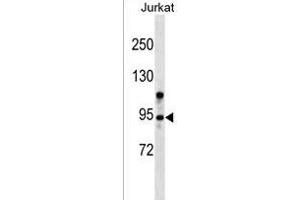 ZMYM6 Antibody (N-term) (ABIN1539123 and ABIN2849256) western blot analysis in Jurkat cell line lysates (35 μg/lane). (ZMYM6 抗体  (N-Term))