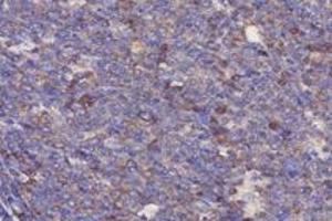 Immunohistochemistry analysis of paraffin-embedded human tonsil using,RPL10 (ABIN7075428) at dilution of 1: 4000 (RPL10 抗体)