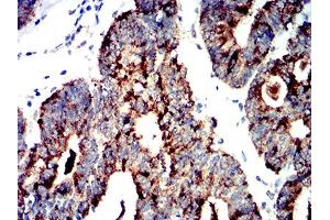 Immunohistochemistry (IHC) image for anti-Protein Kinase, AMP-Activated, alpha 2 Catalytic Subunit (PRKAA2) (AA 453-552) antibody (ABIN5611223)