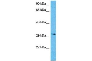 Host:  Mouse  Target Name:  KCNIP3  Sample Tissue:  Mouse Brain  Antibody Dilution:  1ug/ml (DREAM 抗体  (N-Term))