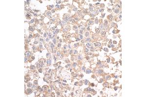 anti-Sperm Associated Antigen 9 (SPAG9) (AA 1-50) antibody
