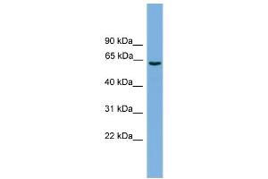 WB Suggested Anti-SLCO1A2 Antibody Titration: 0. (SLCO1A2 抗体  (Middle Region))