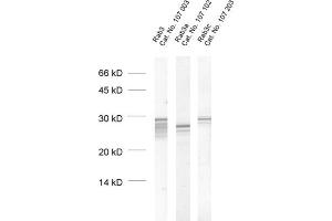 dilution: 1 : 1000, sample: crude synaptosomal fraction of rat brain (P2) (RAB3A 抗体  (AA 154-227))