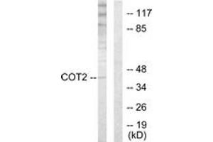 Western blot analysis of extracts from HuvEc cells, using COT2 Antibody. (Grr1p 抗体  (AA 1-50))