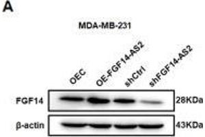 Knockdown of FGF14 partly impairs the FGF14-AS2 inhibitory effect on MDA-MB-231 cell migration and invasion.