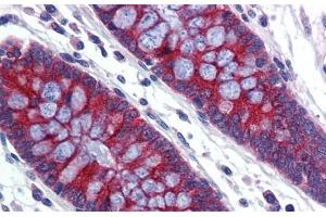 Human Colon; Immunohistochemistry with Human Colon lysate tissue at an antibody concentration of 5. (ABCA5 抗体  (C-Term))