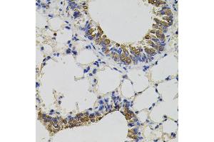 Immunohistochemistry of paraffin-embedded mouse lung using CD59 antibody.