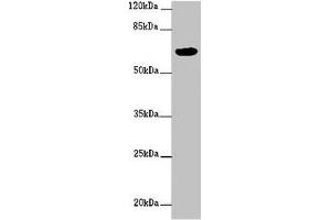 Western blot All lanes: FBXW5 antibody at 2 μg/mL + PC-3 whole cell lysate Secondary Goat polyclonal to rabbit IgG at 1/10000 dilution Predicted band size: 64, 43 kDa Observed band size: 64 kDa (FBXW5 抗体  (AA 265-494))