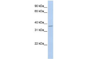 WB Suggested Anti-SLFNL1 Antibody Titration: 0. (Schlafen-Like 1 抗体  (Middle Region))