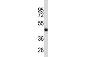 OPG antibody western blot analysis in NCI-H460 lysate. (Osteoprotegerin 抗体  (AA 243-271))