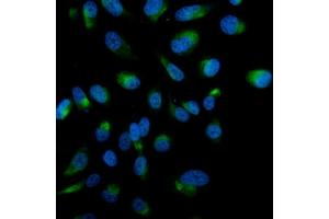 IF analysis of STK3/MST-2 using anti-STK3/MST-2 antibody (ABIN7601288).