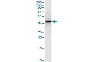 PTX3 monoclonal antibody (M01), clone 5B7. (PTX3 抗体  (AA 282-380))