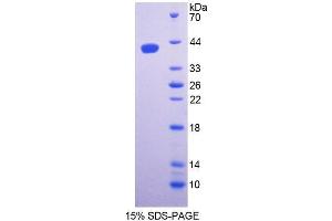 SDS-PAGE (SDS) image for serine Palmitoyltransferase, Long Chain Base Subunit 1 (SPTLC1) (AA 143-473) protein (His tag) (ABIN6237199) (SPTLC1 Protein (AA 143-473) (His tag))