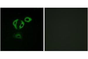Immunofluorescence analysis of A549 cells, using TACC3 Antibody. (TACC3 抗体  (AA 789-838))