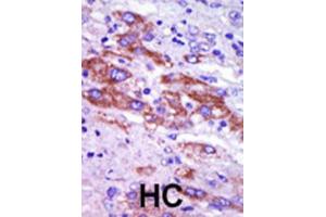 Immunohistochemistry (IHC) image for anti-Casein Kinase 1, delta (CSNK1D) antibody (ABIN3003190) (Casein Kinase 1 delta 抗体)