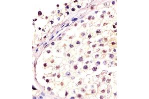 Antibody staining DPPA4 in human testis tissue sections by Immunohistochemistry (IHC-P - paraformaldehyde-fixed, paraffin-embedded sections). (DPPA4 抗体  (N-Term))