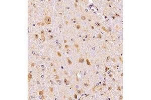 Immunohistochemistry (Paraffin-embedded Sections) (IHC (p)) image for anti-Signal Recognition Particle 14kDa (Homologous Alu RNA Binding Protein) (SRP14) antibody (ABIN7075596)
