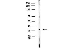 anti-Hypoxia Inducible Factor 1, alpha Subunit Inhibitor (HIF1AN) (C-Term) antibody
