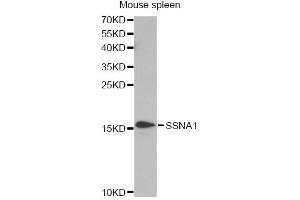 Western blot analysis of extracts of mouse spleen, using SSNA1 antibody. (SSNA1 抗体)
