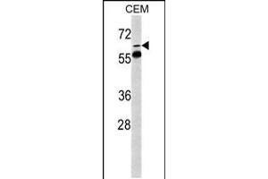 Western blot analysis of FKBP10 Antibody in CEM cell line lysates (35ug/lane) (FKBP10 抗体  (N-Term))