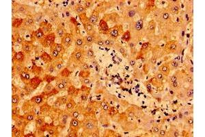 Immunohistochemistry of paraffin-embedded human liver tissue using ABIN7156987 at dilution of 1:100 (IFT46 抗体  (AA 1-304))