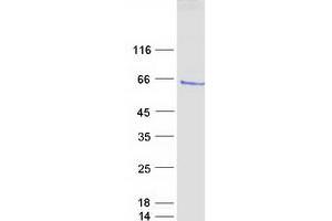 Western Blotting (WB) image for Ets Variant 1 (ETV1) protein (Myc-DYKDDDDK Tag) (ABIN2720583)