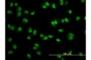 Immunofluorescence of monoclonal antibody to USP15 on HeLa cell. (USP15 抗体  (AA 1-235))