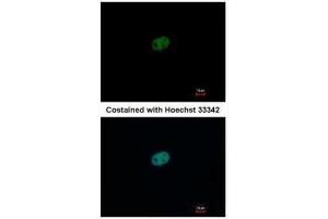 ICC/IF Image Immunofluorescence analysis of paraformaldehyde-fixed HeLa, using RFC2, antibody at 1:500 dilution. (RFC2 抗体)