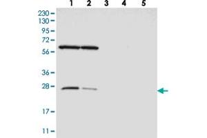 Western blot analysis of Lane 1: RT-4, Lane 2: U-251 MG, Lane 3: Human Plasma, Lane 4: Liver, Lane 5: Tonsil with MRPS15 polyclonal antibody . (MRPS15 抗体)