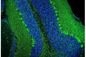 IF analysis of Calbindin using anti-Calbindin antibody (ABIN6719541). (CALB1 抗体  (AA 2-261))