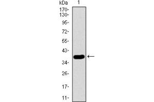 Western blot analysis using SFTPC antibody against HEK293 (1) and SFTPC (AA: 60-180) -hIgGFc transfected HEK293 (2) cell lysate. (Surfactant Protein C 抗体  (AA 60-180))