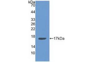 Detection of Recombinant ANXA3, Human using Polyclonal Antibody to Annexin A3 (ANXA3) (Annexin A3 抗体  (AA 26-160))