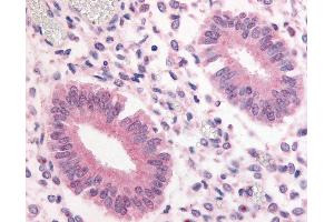 Anti-PDE3A antibody IHC of human uterus. (PDE3A 抗体  (Internal Region))