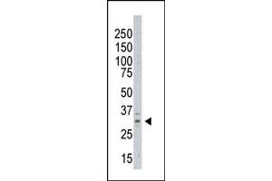 The anti-AURKC Pab (ABIN6242197 and ABIN6578977) is used in Western blot to detect AURKC in  cell lysate (Aurora Kinase C 抗体  (C-Term))