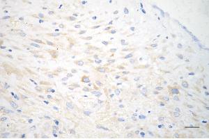 anti-AKT1 Substrate 1 (Proline-Rich) (AKT1S1) (pThr246) antibody