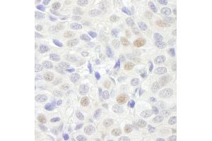 Immunohistochemistry (IHC) image for anti-General Transcription Factor 3C Polypeptide 3 (GTF3C3) (AA 475-525) antibody (ABIN7448586) (General Transcription Factor 3C Polypeptide 3 (GTF3C3) (AA 475-525) 抗体)