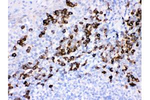 Immunohistochemistry (IHC) image for anti-Peroxiredoxin 4 (PRDX4) (AA 178-2081), (C-Term) antibody (ABIN3043905)