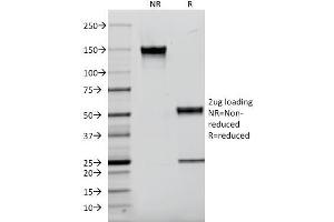 SDS-PAGE Analysis Purified CD9 Mouse Monoclonal Antibody (P1/33/2). (CD9 抗体)
