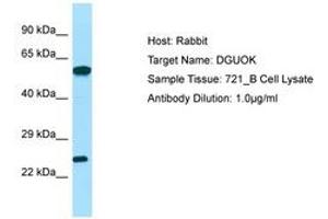 Image no. 1 for anti-Deoxyguanosine Kinase (DGUOK) (C-Term) antibody (ABIN6749986)