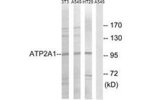 Western blot analysis of extracts from HT-29/A549/NIH-3T3 cells, using ATP2A1 Antibody. (ATP2A1/SERCA1 抗体  (AA 548-597))