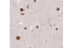 ABIN6278585 staining KIF20A in human brain tissue by Immunohistochemistry (Formalin/PFA-fixed paraffin-embedded sections). (KIF20A 抗体  (C-Term))
