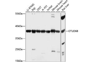 OTUD6B 抗体  (AA 31-323)