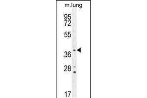 PTK9L Antibody (N-term) (ABIN655611 and ABIN2845093) western blot analysis in mouse lung tissue lysates (35 μg/lane). (TWF2 抗体  (N-Term))